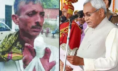 నితీష్ సీఎం అయిన ప్రతిసారి వేలు కత్తిరించుకున్నాడు.. తాజాగా మరో వేలు కూడా..