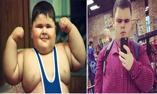 WORLDS HEAVIEST BOY DEAD AT 21