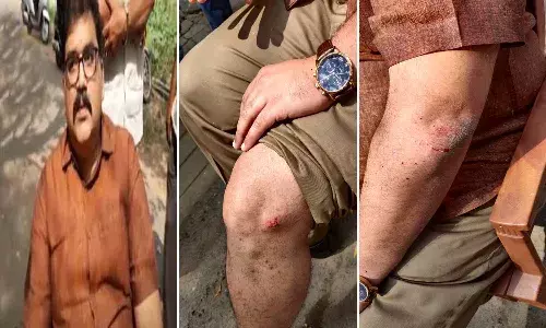 Attack On TDP Leader Pattabi.