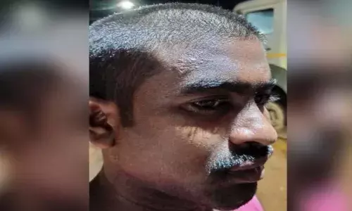 Victim of the head Shaving Person is Disappeared