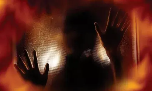 Lover sets girlfriend ablaze