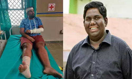 Comedian Viva Harsha injured and hospitalized