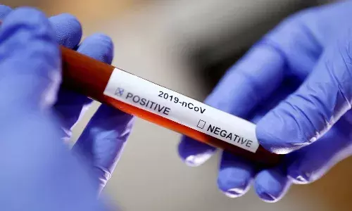 102 New Corona cases in AP