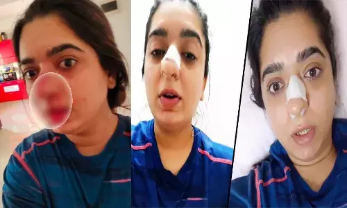 Zomato delivery boy punches woman leaves her bleeding.