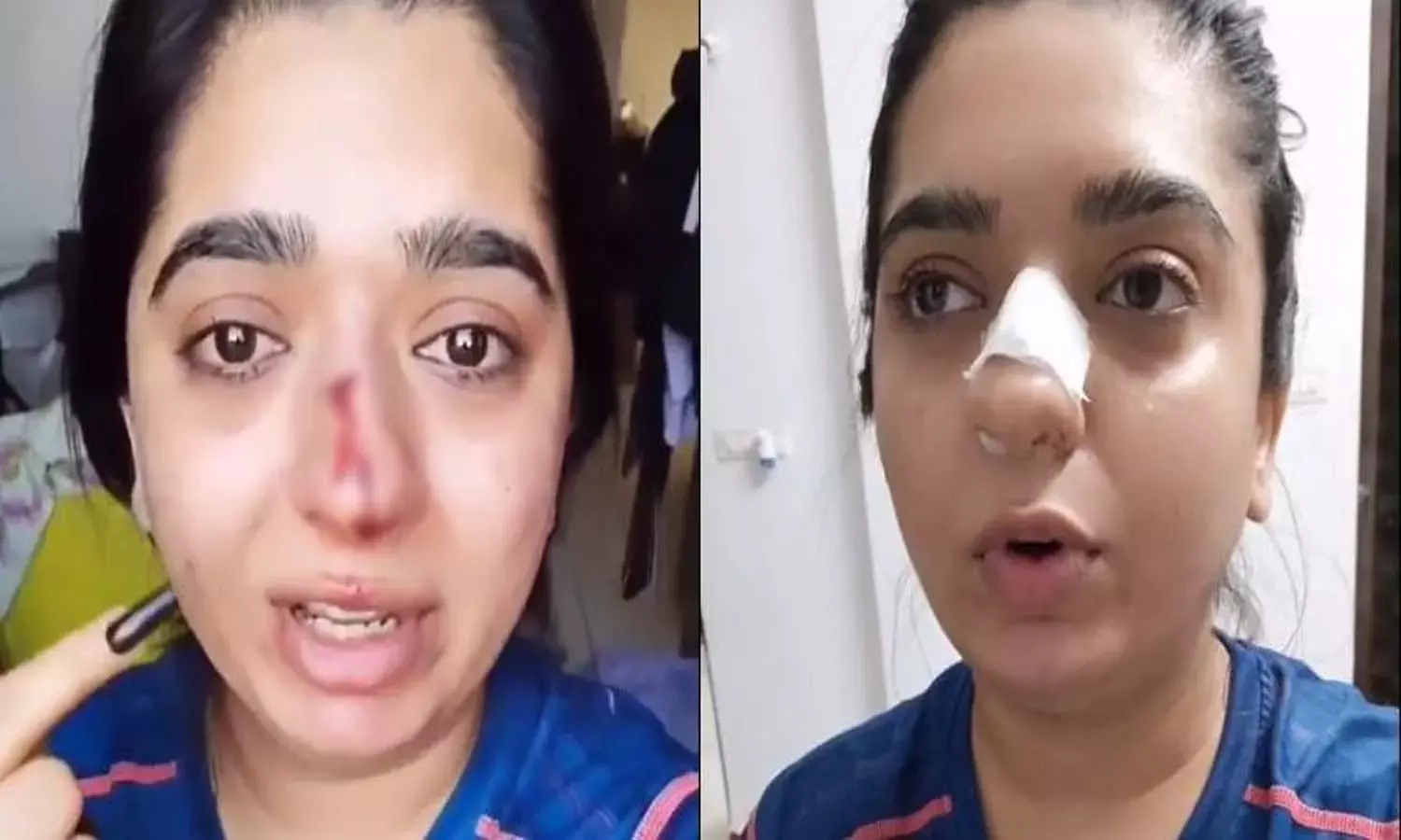 Zomato row: After delivery boy  Kamaraj files FIR, Hitesha Chandranee flees Bengaluru