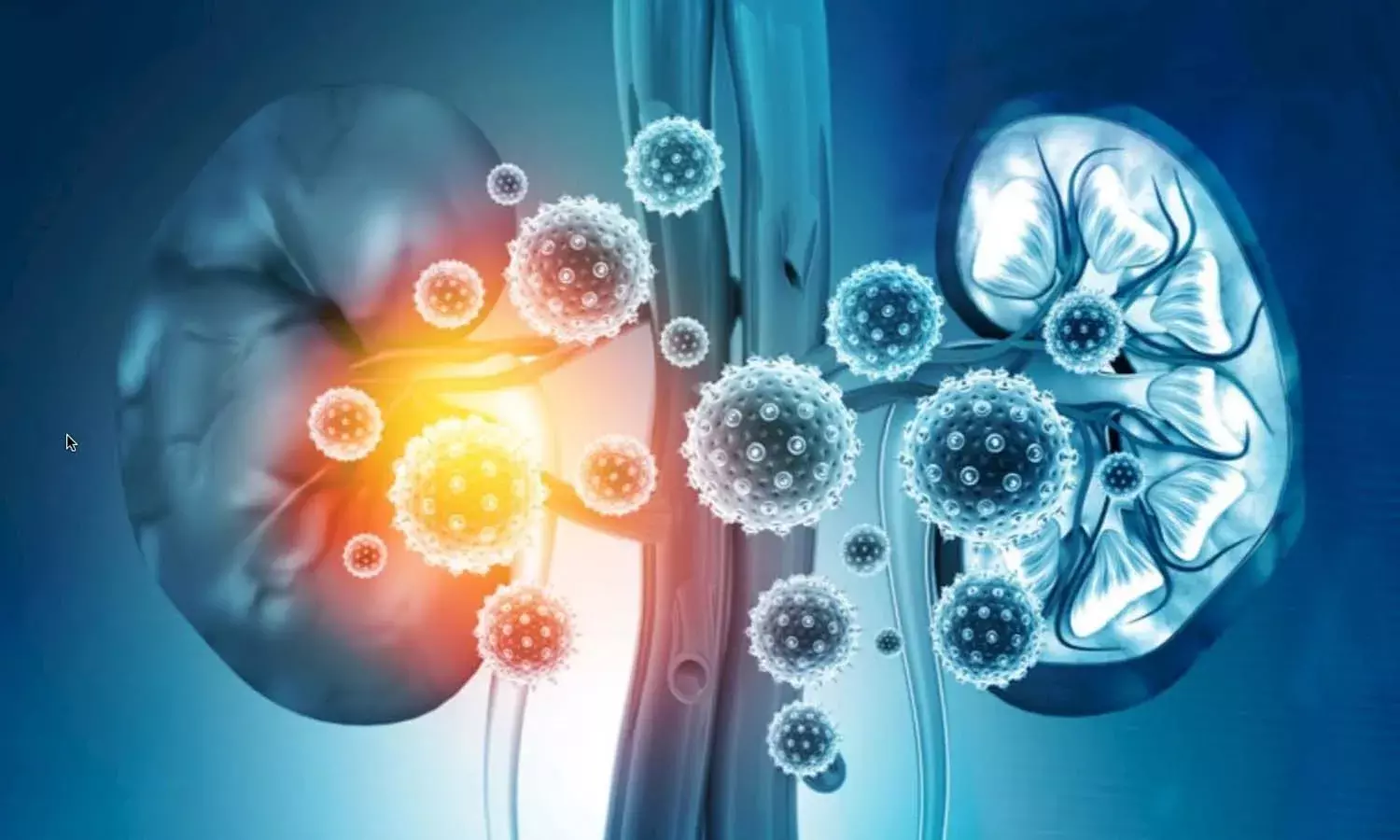 Kidney Problems In Corona Virus Patients