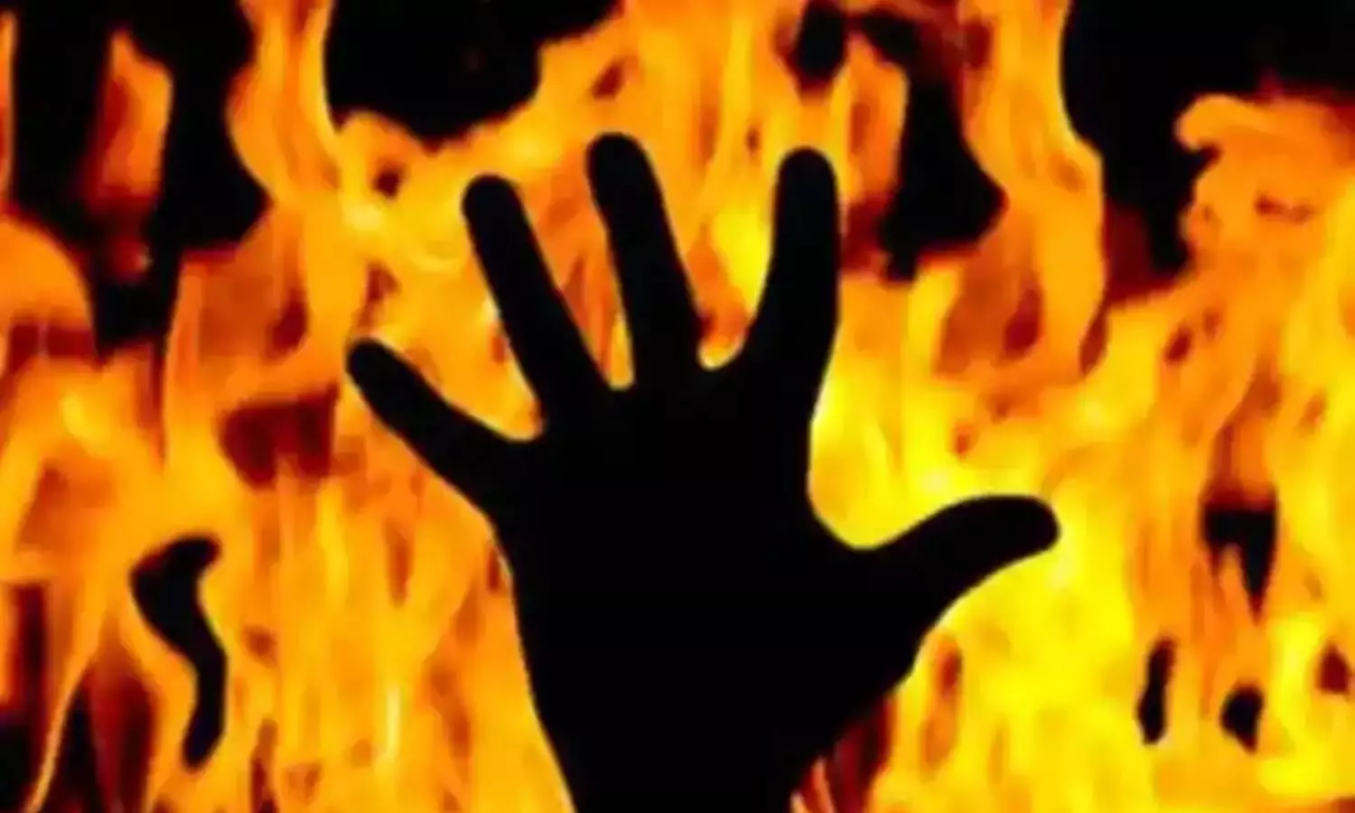 After dinner with father Kolkata woman sets him on fire