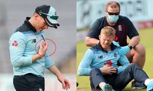 Injured Eoin morgan sam billings doubtful for second odi