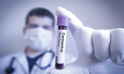 AP corona update