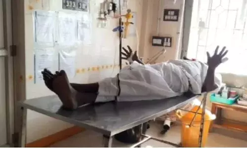 Party worker cut off his finger