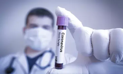 corona virus