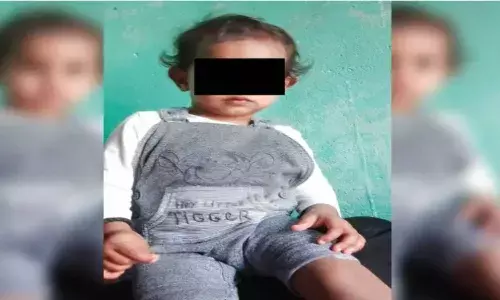 car runs over toddler