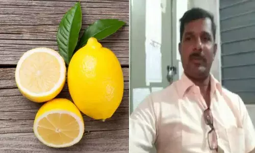 Teacher dies after lemon drops in nose