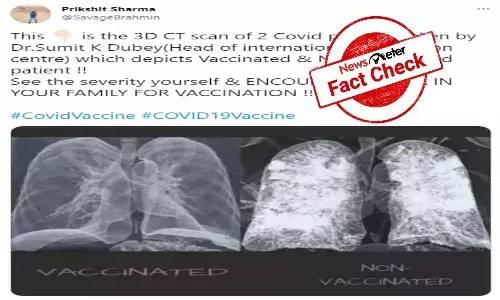 fact check of infected lungs image