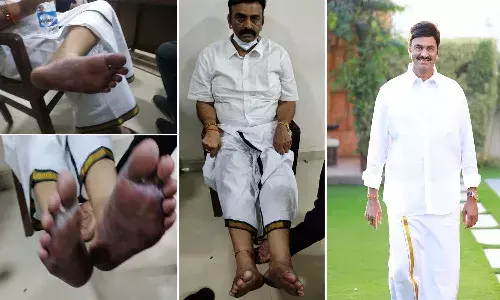 కాళ్లకు గాయాలతో రఘురామ.. తాజా గాయాలని తేలితే తీవ్ర పరిణామాలు తప్పవా..