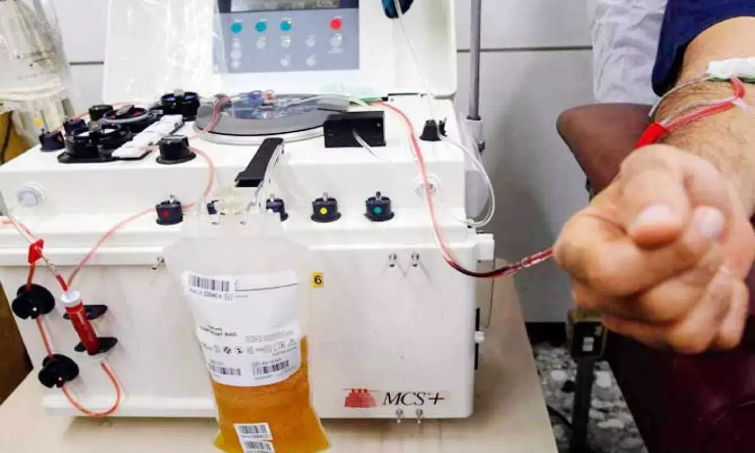 Plasma therapy removed