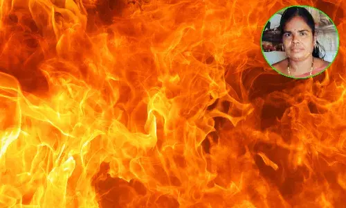 teacher live burnt