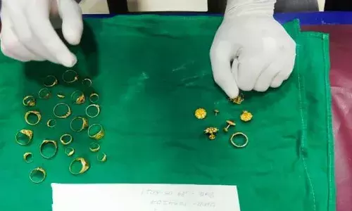 దొంగ పొట్ట‌లో 25 ఉంగ‌రాలు.. ఏం జ‌రిగిందంటే..