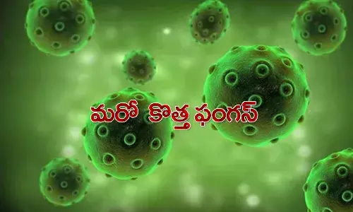 మ‌రో కొత్త ఫంగ‌స్ వెలుగులోకి.. అదే గ్రీన్ ఫంగ‌స్..!