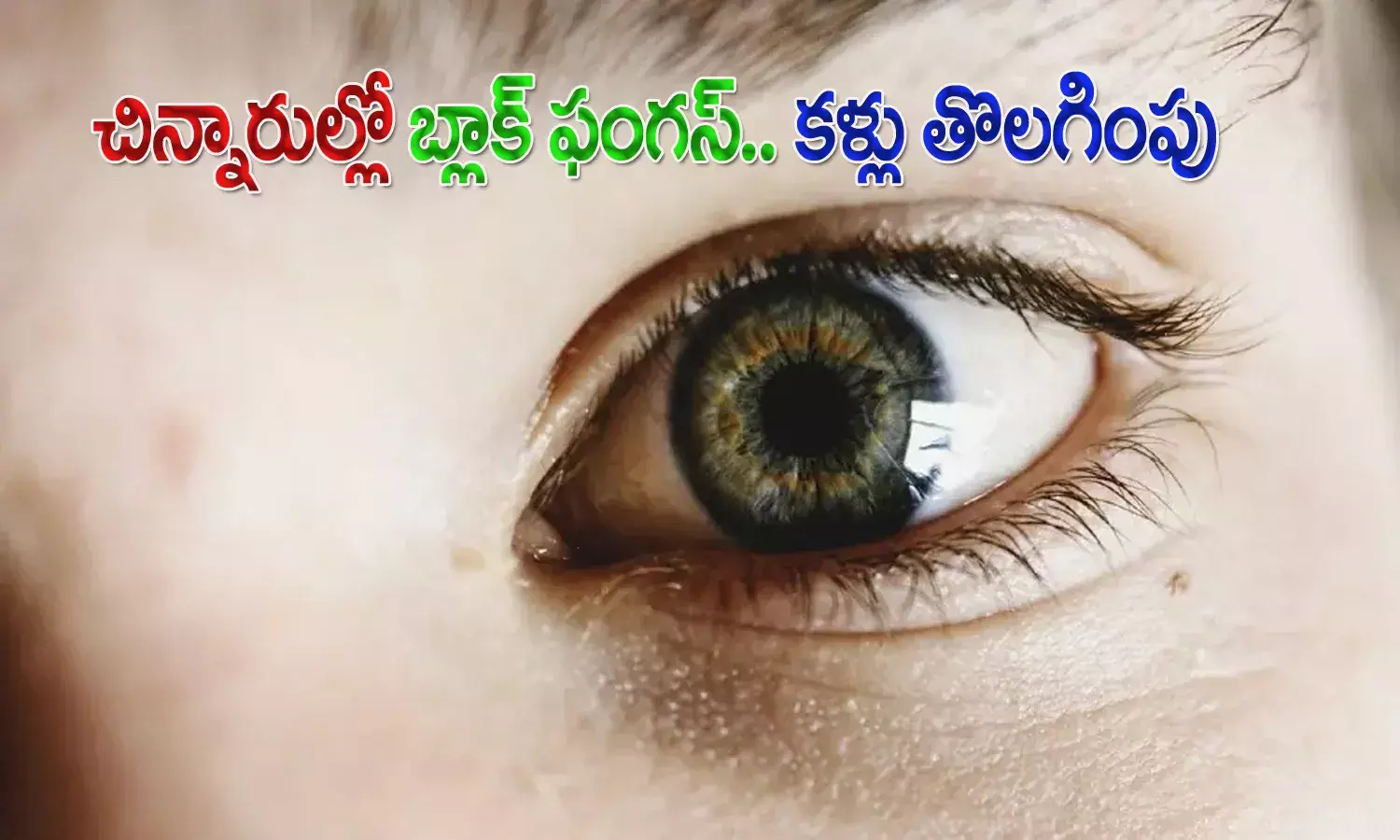 చిన్నారులపై బ్లాక్ ఫంగ‌స్ పంజా.. ముగ్గురు పిల్ల‌ల క‌ళ్లు తొల‌గింపు