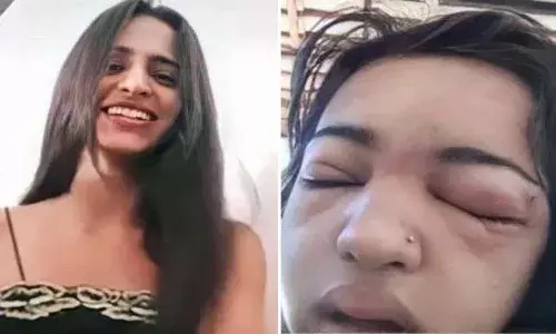 ట్రెండ్ కు తగ్గట్టుగా టీనేజర్ చేసిన ప్రయత్నం.. వెంటిలేటర్ పై ఉండగా నాలుగు సార్లు గుండెపోటు