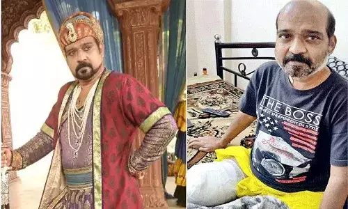 ఆరోగ్యాన్ని నిర్లక్ష్యం చేసిన నటుడు..  వైద్యులు కాలు తొలగించారు