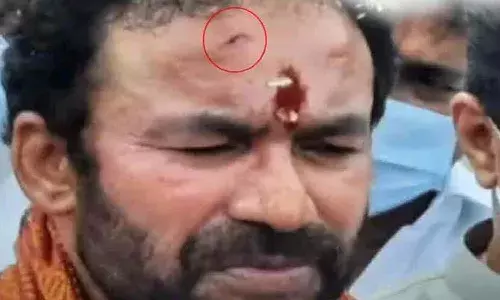 కేంద్ర మంత్రి కిషన్రెడ్డికి గాయం