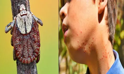 యూపీలో కొత్త ర‌కం వ్యాధి.. 10 మంది మృతి..!