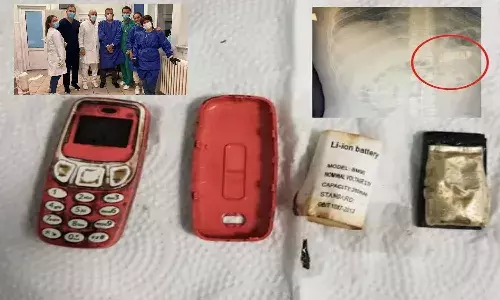 నోకియా 3310 ఫోన్‌ను మింగేసిన వ్యక్తి