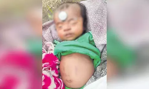 రెండు నెలల చిన్నారి కడుపును కొరికేసిన భూత వైద్యుడు