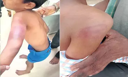 ఉపాధ్యాయురాలి కర్కశం..  నోట్లో నుంచి ఉమ్ము పడిందని