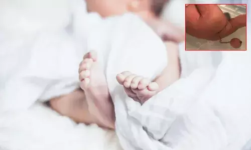 వింత ఘటన.. 12 సెం.మీ తోకతో పుట్టిన బాలుడు