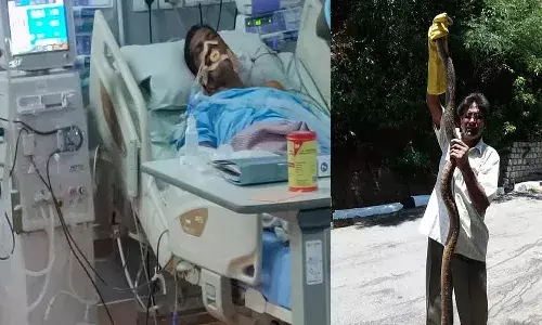 స్నేక్ క్యాచర్ భాస్కర్ నాయుడు పరిస్థితి విషమం