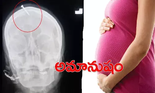 అమానుషం.. కడుపులో బిడ్డను అబ్బాయిగా మారుస్తానంటూ.. గర్భిణి తలకు మేకు