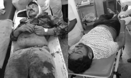 రోడ్డు ప్రమాదం.. వైసీపీ ఎమ్మెల్యే కుమారుడికి గాయాలు