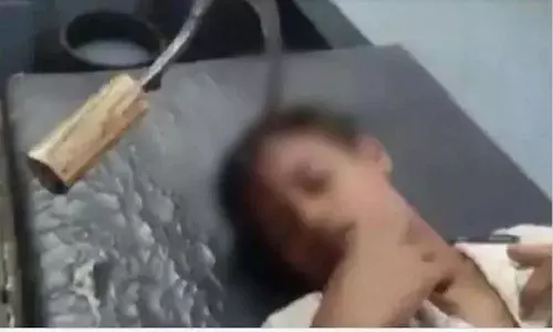 పదునైన ఆయుధం బాలుడి తలలోకి దూసుకుపోయింది.. నొప్పి లేదు, రక్తం రాలేదు