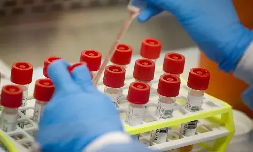 భారీగా తగ్గిన కరోనా కేసులు.. కొత్తగా ఎన్నంటే