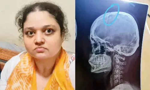 జంతువులకు ఆహారం పెడుతోందని మహిళా వెటర్నరీ డాక్టర్ తలపై బాదడంతో..
