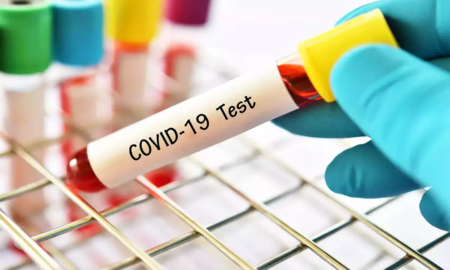 దేశంలో పెరుగుతున్న క‌రోనా కేసులు