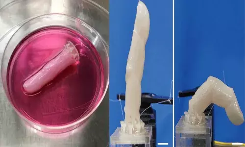 రోబోకు మనిషి చర్మం