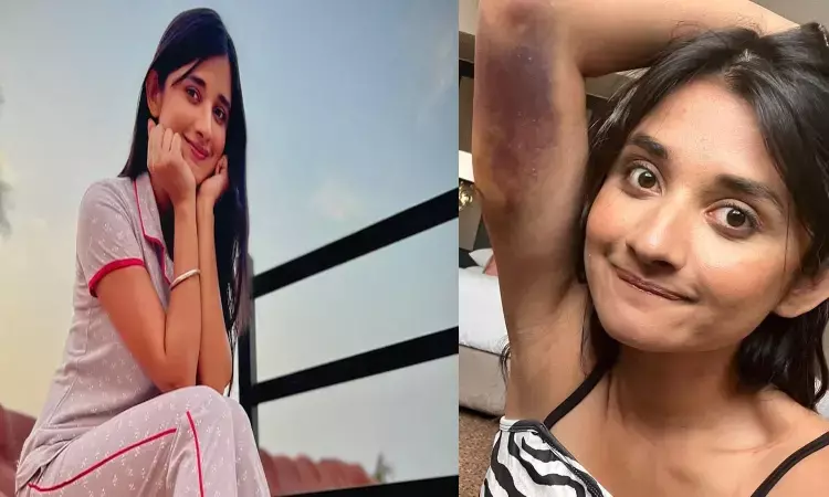 గాయ‌ప‌డిన‌ నటి.. షో అలాంటిది..!