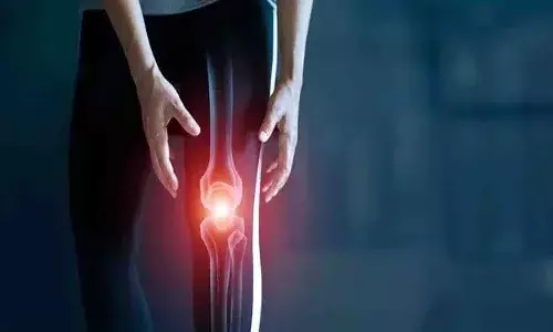 యుక్త వయసులో ఆస్టియో అర్థరైటీస్.. తెలుసుకోవాల్సిన అంశాలు