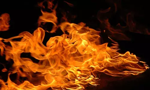 భార్య‌పై అనుమానం.. కుమారుడిపై కిరోసిన్ పోసి నిప్పంటించిన తండ్రి