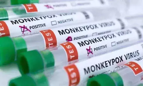 విజయవాడలో మంకీపాక్స్ కలకలంపై క్లారిటీ