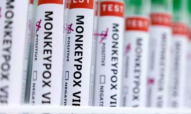 పురుషులతో పురుషుల లైంగిక సంబంధాలే మంకీపాక్స్ వ్యాప్తికి కార‌ణం..!