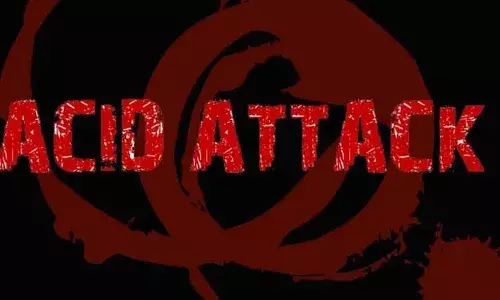 చెంపపై కొట్టాడని.. భర్తపై యాసిడ్లో కారంపొడి కలిపి పోసిన భార్య