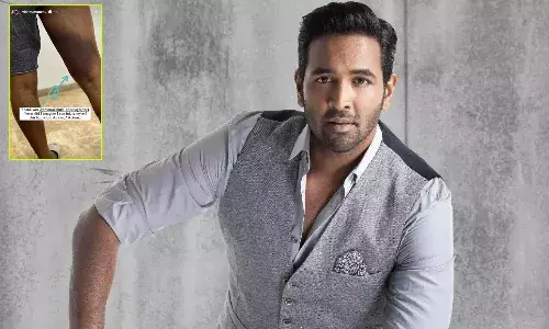 షూటింగ్లో గాయపడ్డ మంచు విష్ణు.. కాలికి గాయం.. అతడే కారణం అంటూ పోస్ట్