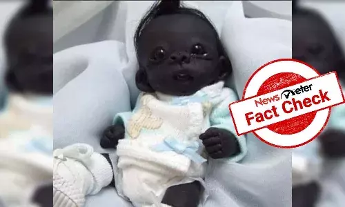 Fact Check: ప్రపంచంలోనే అత్యంత నలుపున్న చిన్నారి అంటూ ప్రచారం..?