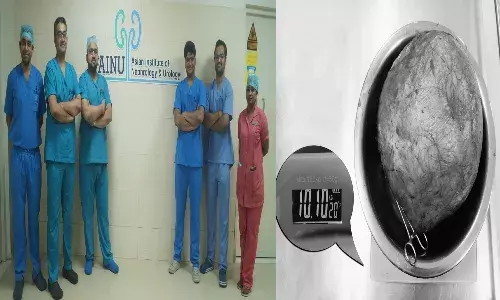 10 కిలోల ఫుట్‌బాల్ పరిమాణంలో ఉన్న పొత్తికడుపు కణితి తొల‌గింపు