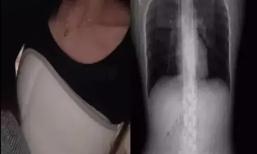 ఇదెక్కడి విచిత్రం.. దగ్గితేనే విరిగిన పక్కటెముకలు..!